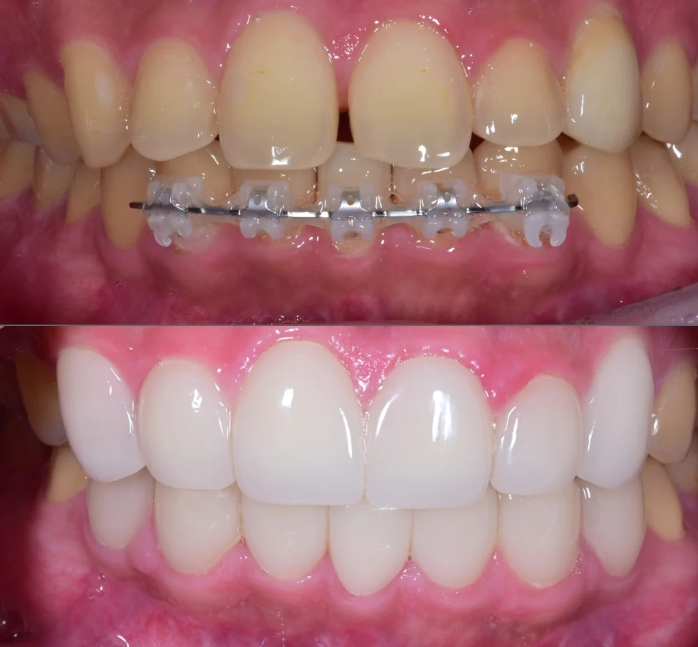 Case Image