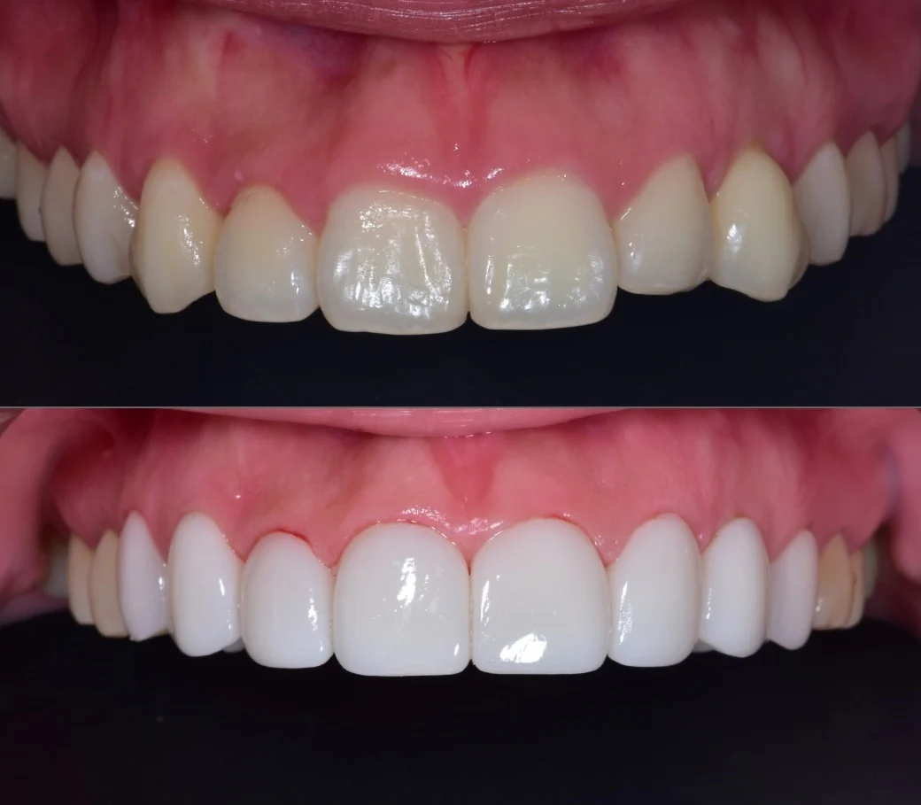 Case Image