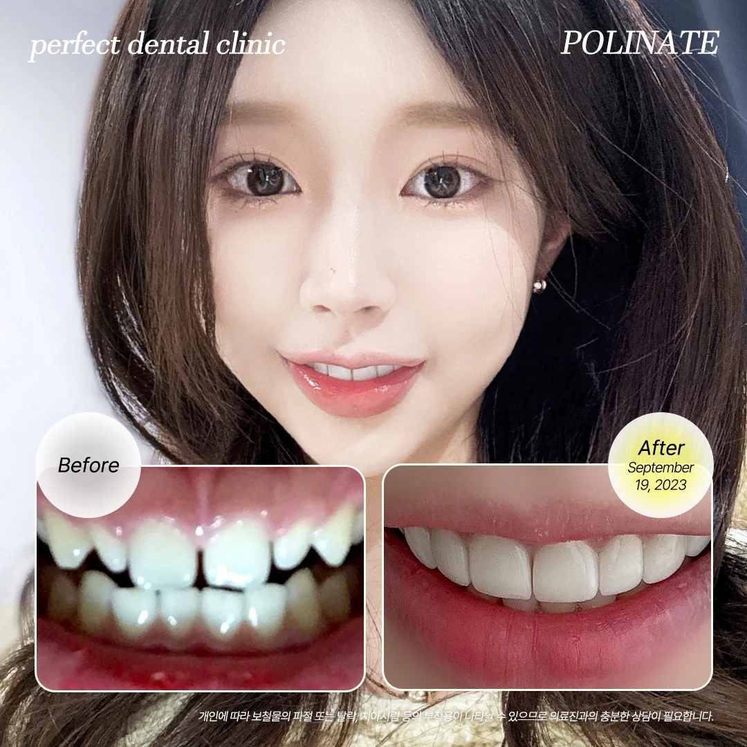 Case Image