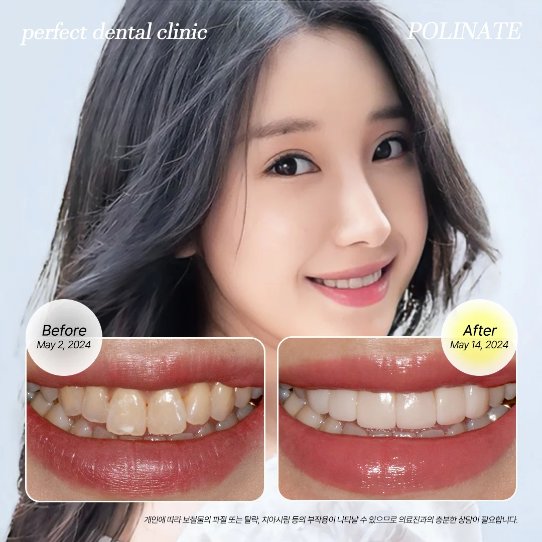 Case Image