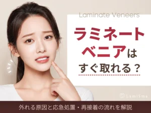 ラミネートベニアはすぐ取れる？外れる原因と応急処置・再接着の流れを解説