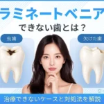 ラミネートベニアができない歯とは？治療できないケースと対処法を解説