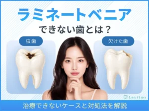 ラミネートベニアができない歯とは？治療できないケースと対処法を解説