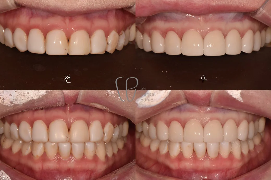 Case Image