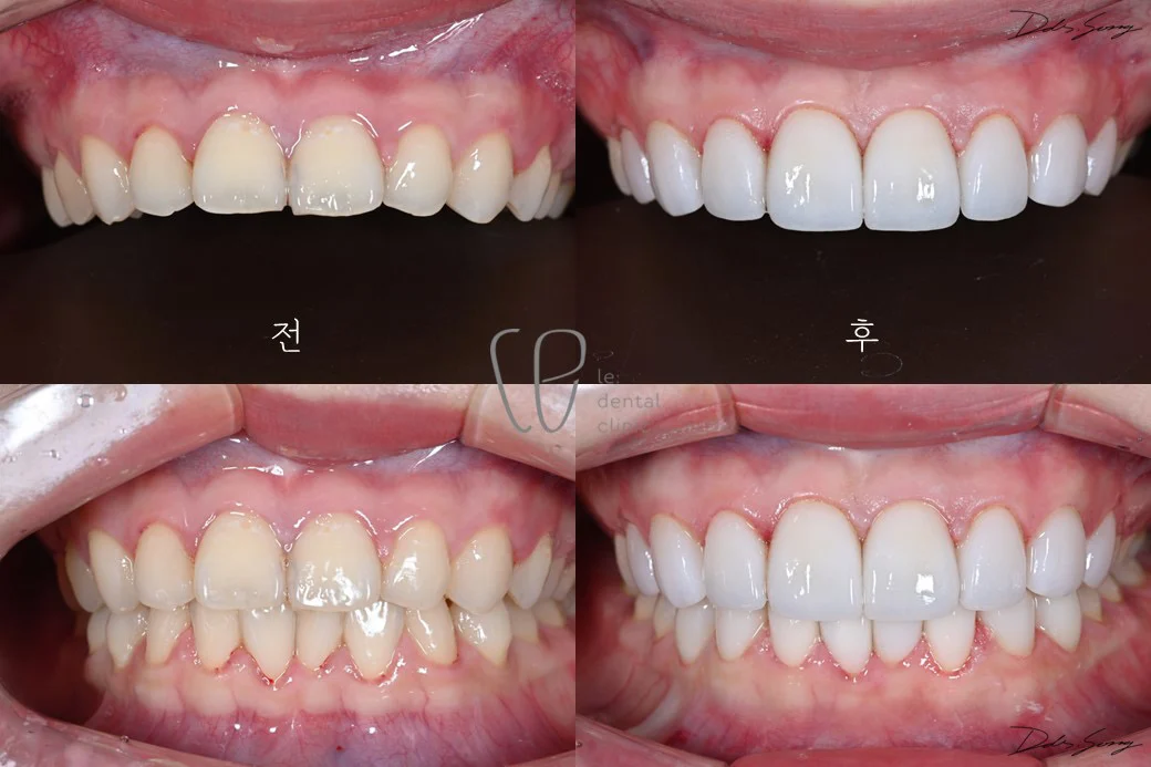 Case Image