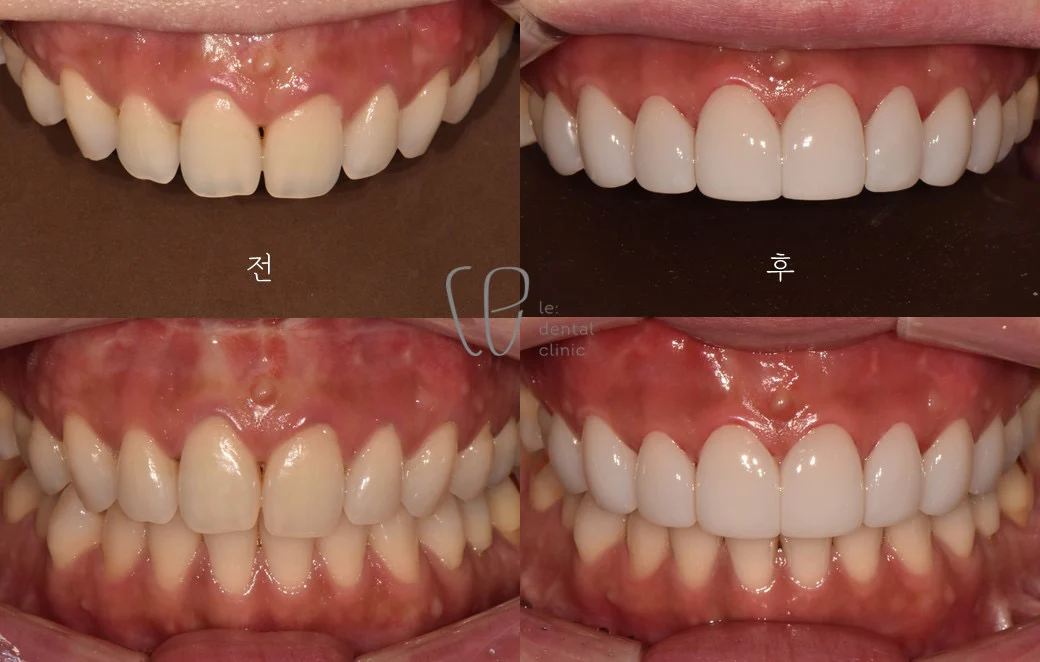 Case Image